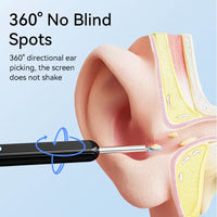 Limpiador De Oídos Con Cámara HD 5MP – Extractor De Cerumen Visual Y Seguro